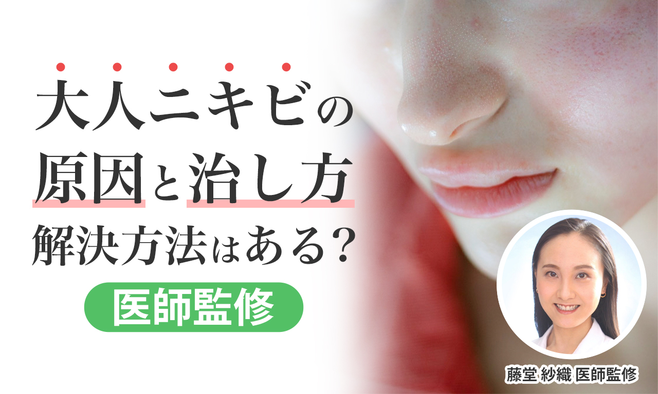 【医師監修】大人ニキビが全然治らない！原因（おでこにできる理由）と治し方